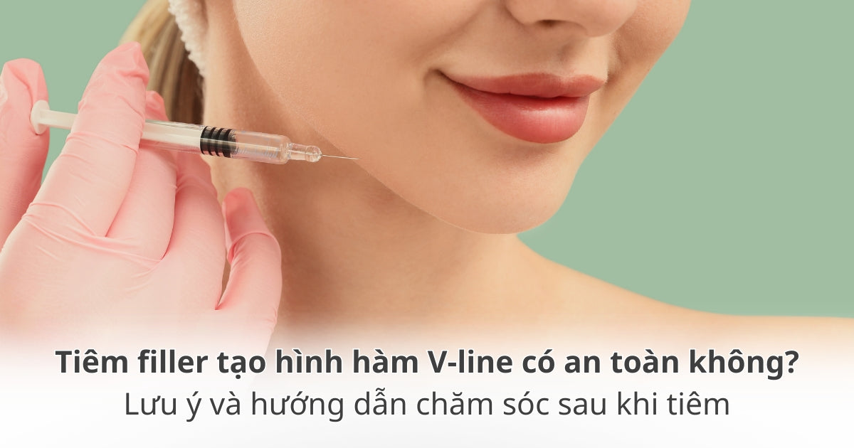 Tiêm filler tạo hình hàm V-line
