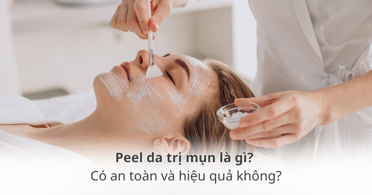 Peel da trị mụn là gì? Có an toàn và hiệu quả không? - Drmall