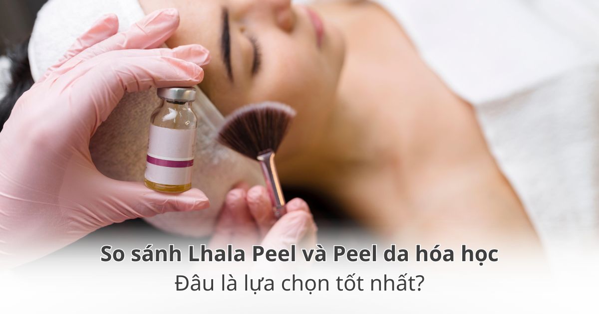 So sánh peel da LHALA và peel da hoá học