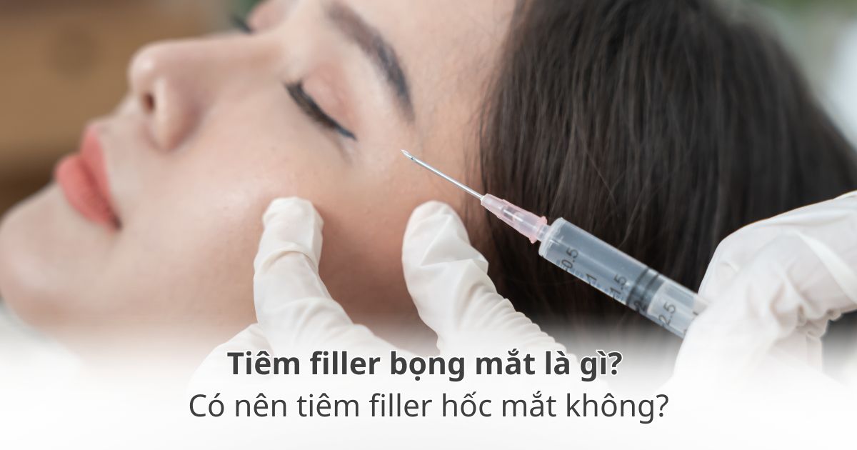 Tiêm filler bọng mắt và hốc mắt