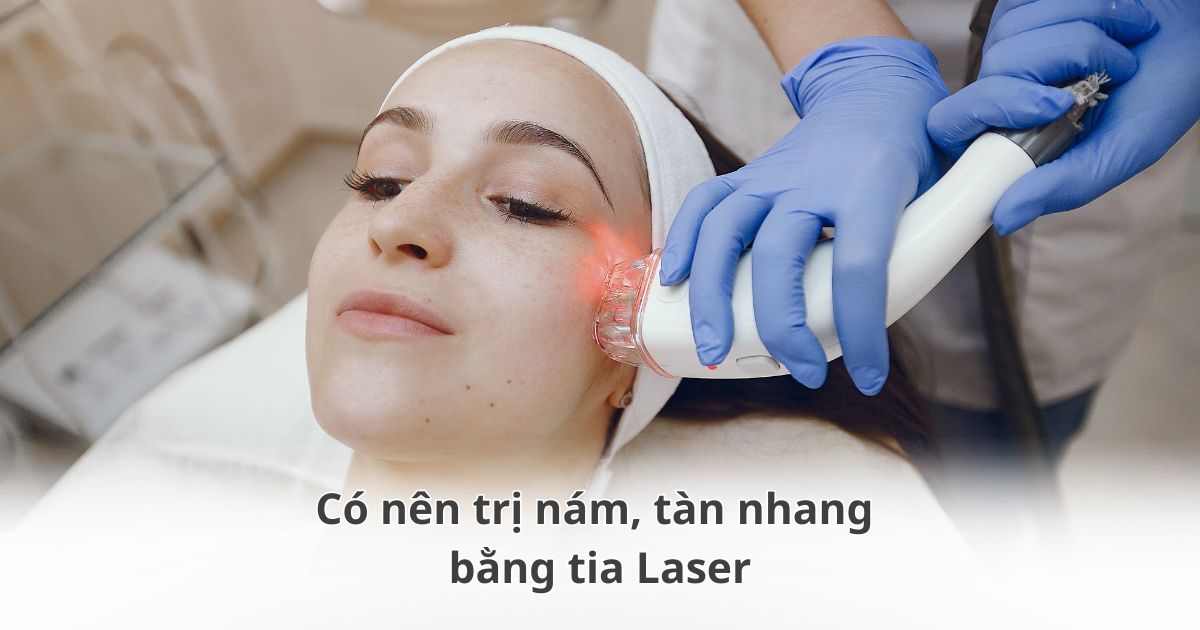 Có nên trị nám, tàn nhang bằng tia Laser?