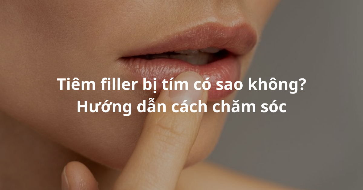 Hình ảnh chăm sóc da sau tiêm filler bị thâm tím