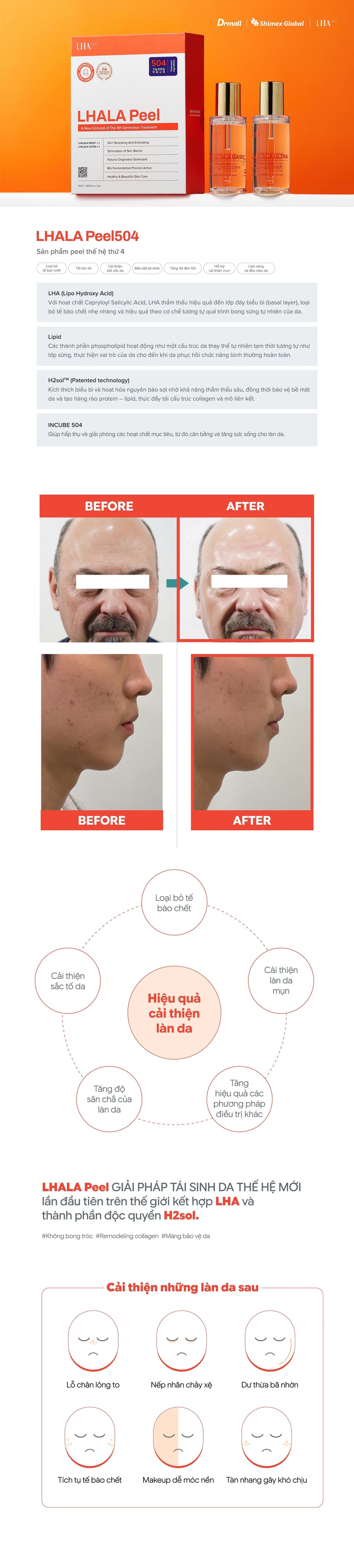 Kết quả da trước và sau khi dùng LHALA Peel Set